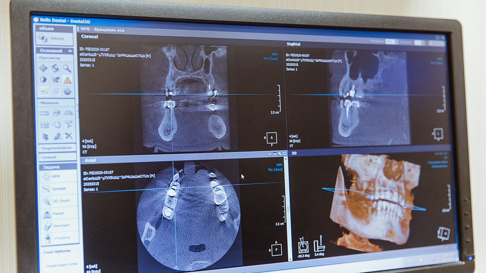 Чем отличается компьютерная томография от рентгена зубов